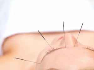 Acupuncture and Eye Pain