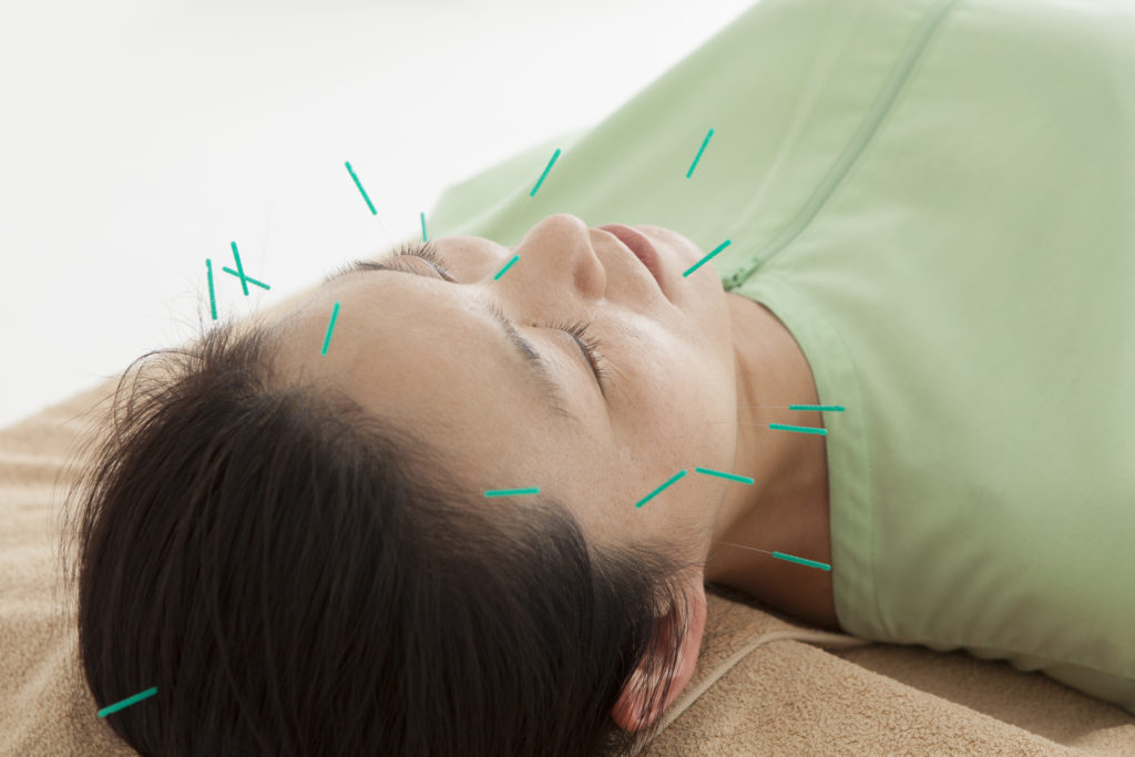 facial-rejuvenation-or-cosmetic-acupuncture-pearl-acupuncture